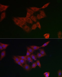 Invitrogen GCLM Polyclonal Antibody 100 &mu;L; Unconjugated:Antibodies,