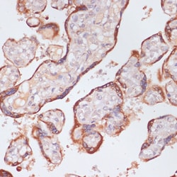 Invitrogen Plasma Kallikrein Polyclonal Antibody 100 &mu;L; Unconjugated:Antibodies,