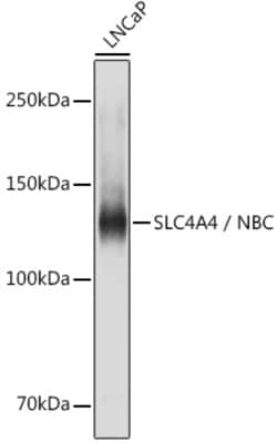 Invitrogen SLC4A4 Polyclonal Antibody 100 &mu;L | Buy Online | Invitrogen&trade; | Fisher Scientific