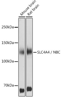 Invitrogen SLC4A4 Polyclonal Antibody 100 &mu;L | Buy Online | Invitrogen&trade; | Fisher Scientific