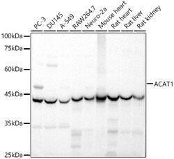 Invitrogen ACAT1 Polyclonal Antibody 100 &mu;L; Unconjugated:Antibodies,