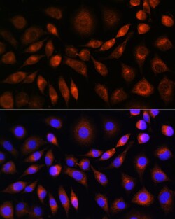 Invitrogen&trade;&nbsp;Apolipoprotein M Polyclonal Antibody