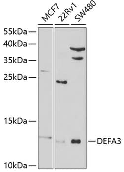 Invitrogen Defensin alpha-3 Polyclonal Antibody 100 &mu;L; Unconjugated:Antibodies,