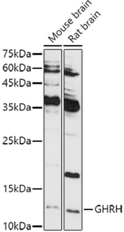 Invitrogen GHRH Polyclonal Antibody 100 &mu;L; Unconjugated:Antibodies,
