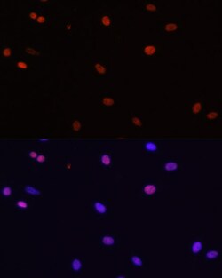 Invitrogen HDGF Polyclonal Antibody 100 &mu;L; Unconjugated:Antibodies,