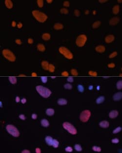 Invitrogen HDGF Polyclonal Antibody 100 &mu;L; Unconjugated:Antibodies,