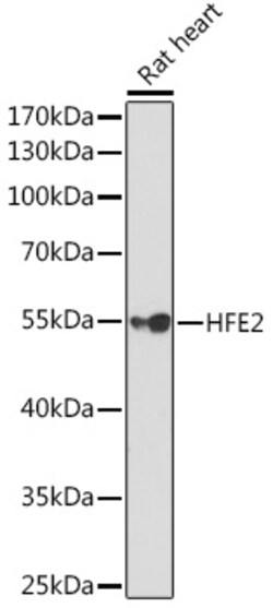 Invitrogen HFE2 Polyclonal Antibody 100 &mu;L; Unconjugated:Antibodies,