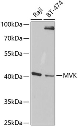 Invitrogen MVK Polyclonal Antibody 100 &mu;L; Unconjugated:Antibodies,