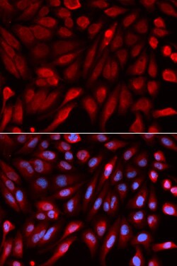 Invitrogen Syntenin 1 Polyclonal Antibody 100 &mu;L; Unconjugated:Antibodies,
