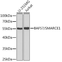 Invitrogen BAF57 Polyclonal Antibody 100 &mu;L; Unconjugated:Antibodies,