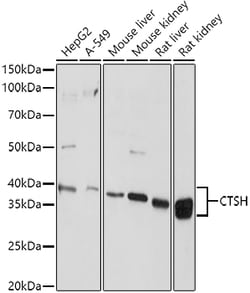 Invitrogen Cathepsin H Polyclonal Antibody 100 &mu;L | Buy Online | Invitrogen&trade; | Fisher Scientific