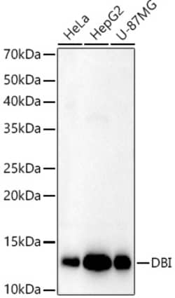 Invitrogen DBI Polyclonal Antibody 100 &mu;L; Unconjugated:Antibodies,
