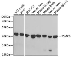 Invitrogen PSMC6 Polyclonal Antibody 100 &mu;L; Unconjugated:Antibodies,