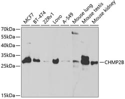Invitrogen CHMP2B Polyclonal Antibody 100 &mu;L; Unconjugated:Antibodies,