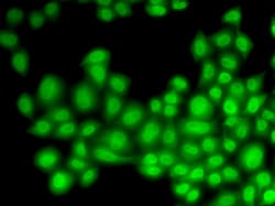 Invitrogen Cullin 4B Polyclonal Antibody 100 &mu;L; Unconjugated:Antibodies,