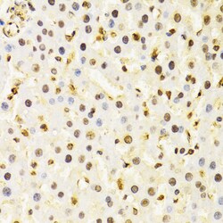 Invitrogen Cullin 4B Polyclonal Antibody 100 &mu;L; Unconjugated:Antibodies,