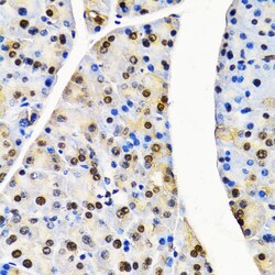 Invitrogen Cullin 4B Polyclonal Antibody 100 &mu;L; Unconjugated:Antibodies,