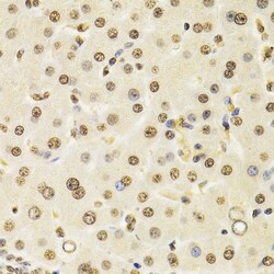Invitrogen Cullin 4B Polyclonal Antibody 100 &mu;L; Unconjugated:Antibodies,