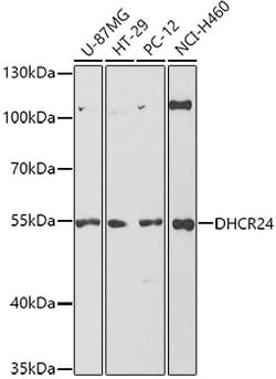 Invitrogen DHCR24 Polyclonal Antibody 100 &mu;L; Unconjugated:Antibodies,