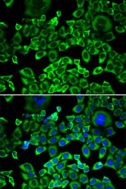 Invitrogen eIF4B Polyclonal Antibody 100 &mu;L | Buy Online | Invitrogen&trade; | Fisher Scientific