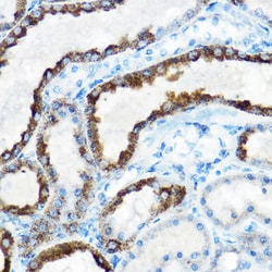 Invitrogen OAT Polyclonal Antibody 100 &mu;L | Buy Online | Invitrogen&trade; | Fisher Scientific