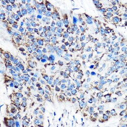 Invitrogen OAT Polyclonal Antibody 100 &mu;L | Buy Online | Invitrogen&trade; | Fisher Scientific