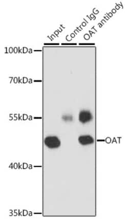 Invitrogen OAT Polyclonal Antibody 100 &mu;L | Buy Online | Invitrogen&trade; | Fisher Scientific