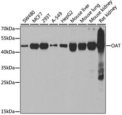 Invitrogen OAT Polyclonal Antibody 100 &mu;L | Buy Online | Invitrogen&trade; | Fisher Scientific