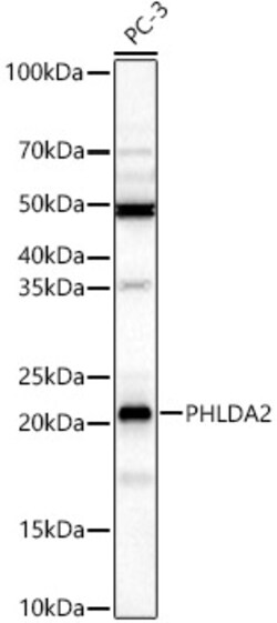 Invitrogen PHLDA2 Polyclonal Antibody 100 &mu;L; Unconjugated:Antibodies,
