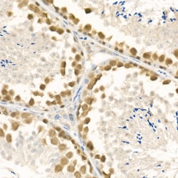 Invitrogen RAD51 Polyclonal Antibody 100 &mu;L; Unconjugated:Antibodies,