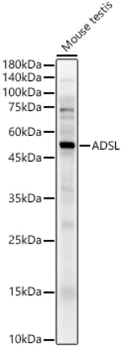 Invitrogen ADSL Polyclonal Antibody 100 &mu;L | Buy Online | Invitrogen&trade; | Fisher Scientific