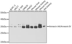 Invitrogen Annexin A4 Polyclonal Antibody 100 &mu;L; Unconjugated:Antibodies,