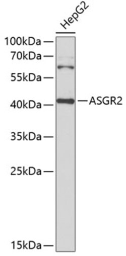 Invitrogen ASGR2 Polyclonal Antibody 100 &mu;L | Buy Online | Invitrogen&trade; | Fisher Scientific