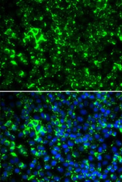 Invitrogen KV1.2 (KCNA2) Polyclonal Antibody 100 &mu;L; Unconjugated:Antibodies,