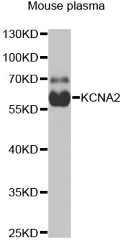 Invitrogen KV1.2 (KCNA2) Polyclonal Antibody 100 &mu;L; Unconjugated:Antibodies,