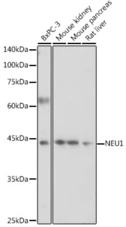 Invitrogen NEU1 Polyclonal Antibody 100 &mu;L; Unconjugated:Antibodies,