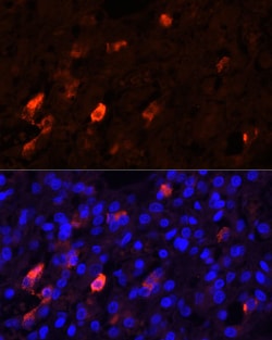 Invitrogen PENK Polyclonal Antibody 100 &mu;L; Unconjugated:Antibodies,