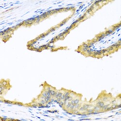Invitrogen PENK Polyclonal Antibody 100 &mu;L; Unconjugated:Antibodies,