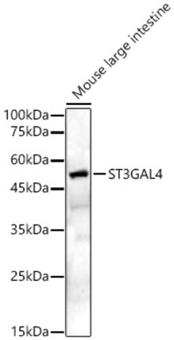 Invitrogen ST3GAL4 Polyclonal Antibody 100 &mu;L; Unconjugated:Antibodies,