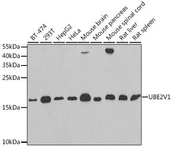 Invitrogen UBE2V1 Polyclonal Antibody 100 &mu;L; Unconjugated:Antibodies,