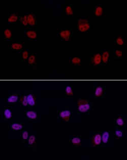 Invitrogen GAS41 Polyclonal Antibody 100 &mu;L; Unconjugated:Antibodies,