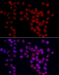Invitrogen GAS41 Polyclonal Antibody 100 &mu;L; Unconjugated:Antibodies,