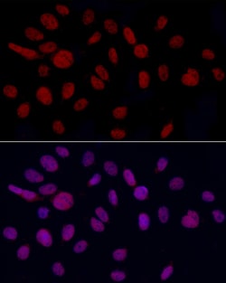 Invitrogen GAS41 Polyclonal Antibody 100 &mu;L; Unconjugated:Antibodies,