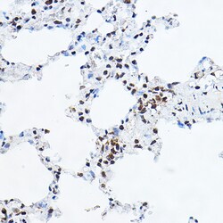 Invitrogen GAS41 Polyclonal Antibody 100 &mu;L; Unconjugated:Antibodies,