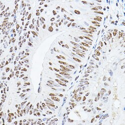 Invitrogen GAS41 Polyclonal Antibody 100 &mu;L; Unconjugated:Antibodies,