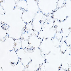 Invitrogen GAS41 Polyclonal Antibody 100 &mu;L; Unconjugated:Antibodies,