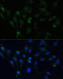 Invitrogen ZWINT Polyclonal Antibody 100 &mu;L; Unconjugated:Antibodies,