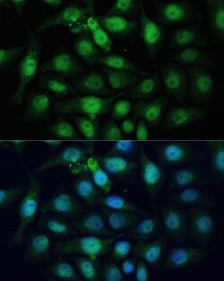 Invitrogen ZWINT Polyclonal Antibody 100 &mu;L; Unconjugated:Antibodies,