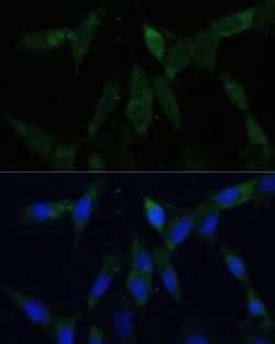 Invitrogen ZWINT Polyclonal Antibody 100 &mu;L; Unconjugated:Antibodies,