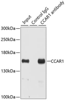 CCAR1 Polyclonal Antibody:Antibodies, Polyclonal